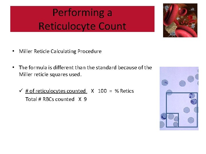 Performing a Reticulocyte Count • Miller Reticle Calculating Procedure • The formula is different