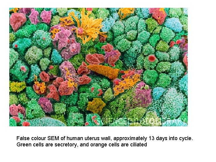 False colour SEM of human uterus wall, approximately 13 days into cycle. Green cells