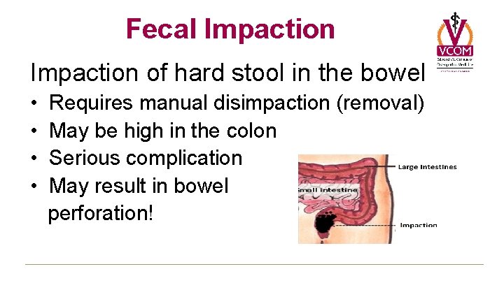 Fecal Impaction of hard stool in the bowel • • Requires manual disimpaction (removal) Fecal Impaction of hard stool in the bowel • • Requires manual disimpaction (removal)