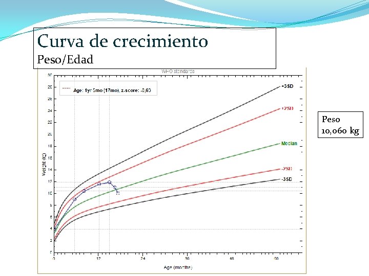Curva de crecimiento Peso/Edad Peso 10, 060 kg 