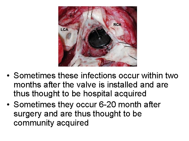  • Sometimes these infections occur within two months after the valve is installed