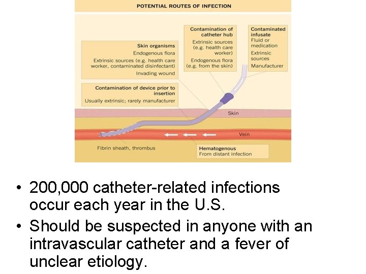  • 200, 000 catheter-related infections occur each year in the U. S. •