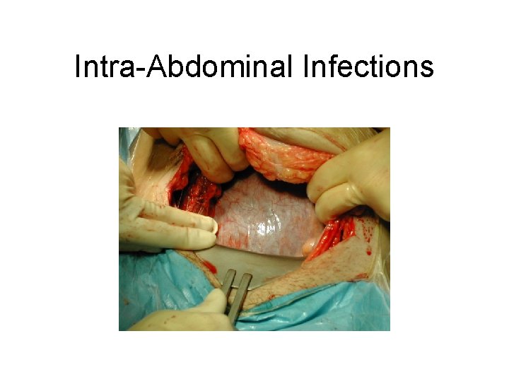 Intra-Abdominal Infections Intra-Abdominal Infections