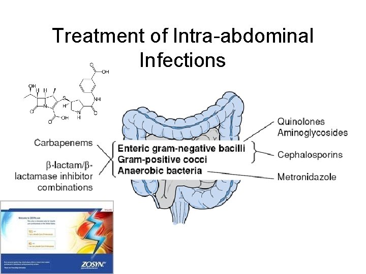 Treatment of Intra-abdominal Infections Treatment of Intra-abdominal Infections