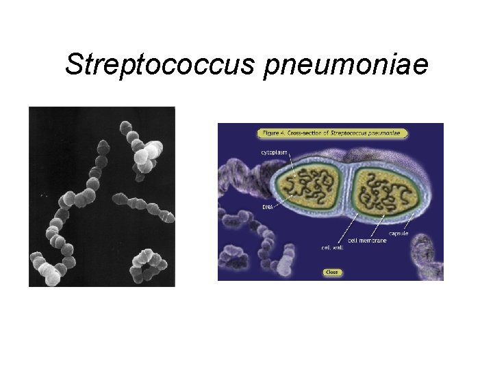 Streptococcus pneumoniae 