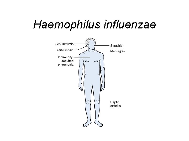 Haemophilus influenzae 