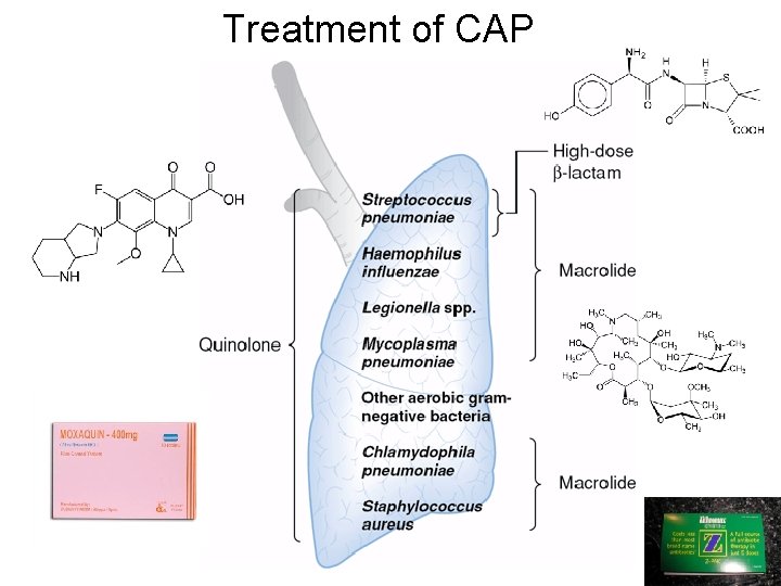 Treatment of CAP 