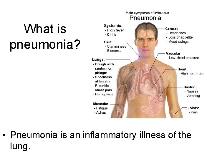 What is pneumonia? • Pneumonia is an inflammatory illness of the lung. What is pneumonia? • Pneumonia is an inflammatory illness of the lung.