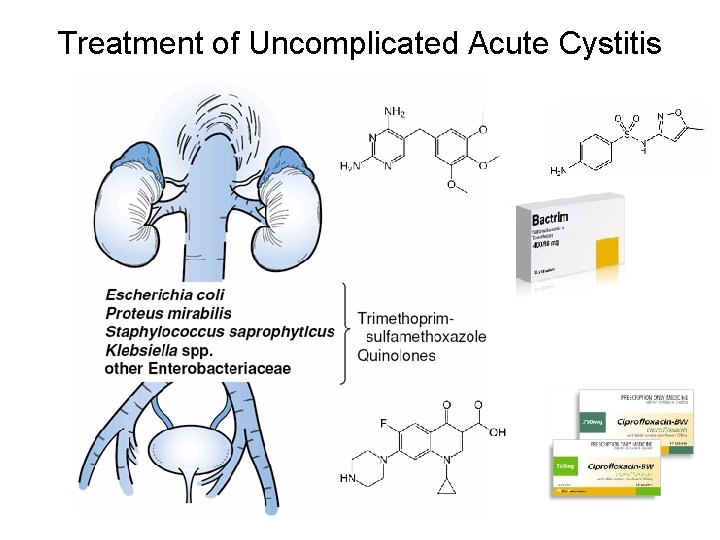 Treatment of Uncomplicated Acute Cystitis 