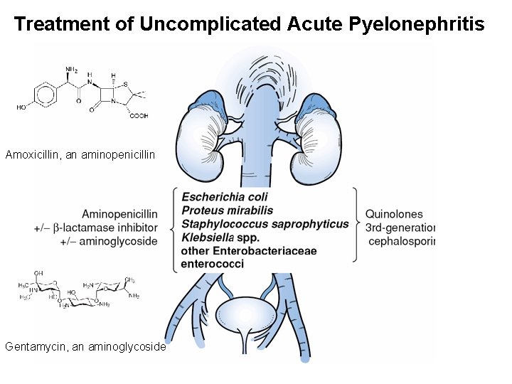 Treatment of Uncomplicated Acute Pyelonephritis Amoxicillin, an aminopenicillin Gentamycin, an aminoglycoside 