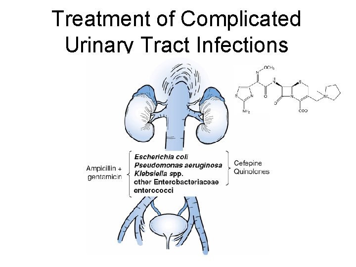 Treatment of Complicated Urinary Tract Infections Treatment of Complicated Urinary Tract Infections