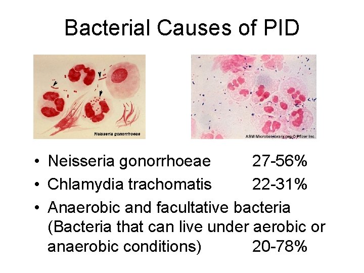 Bacterial Causes of PID • Neisseria gonorrhoeae 27 -56% • Chlamydia trachomatis 22 -31%