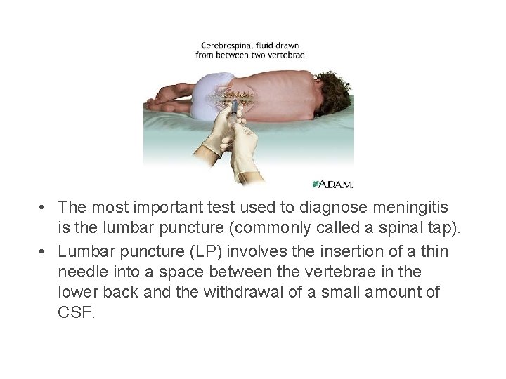  • The most important test used to diagnose meningitis is the lumbar puncture