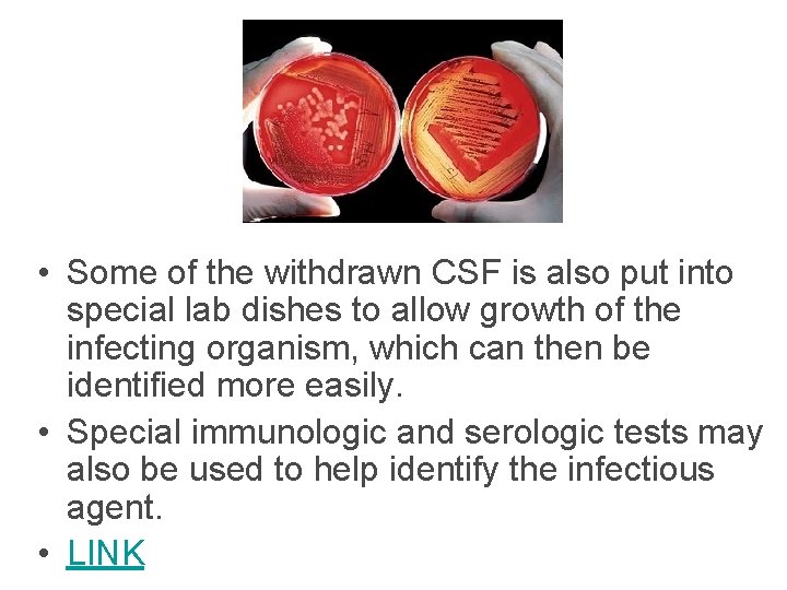 • Some of the withdrawn CSF is also put into special lab dishes • Some of the withdrawn CSF is also put into special lab dishes