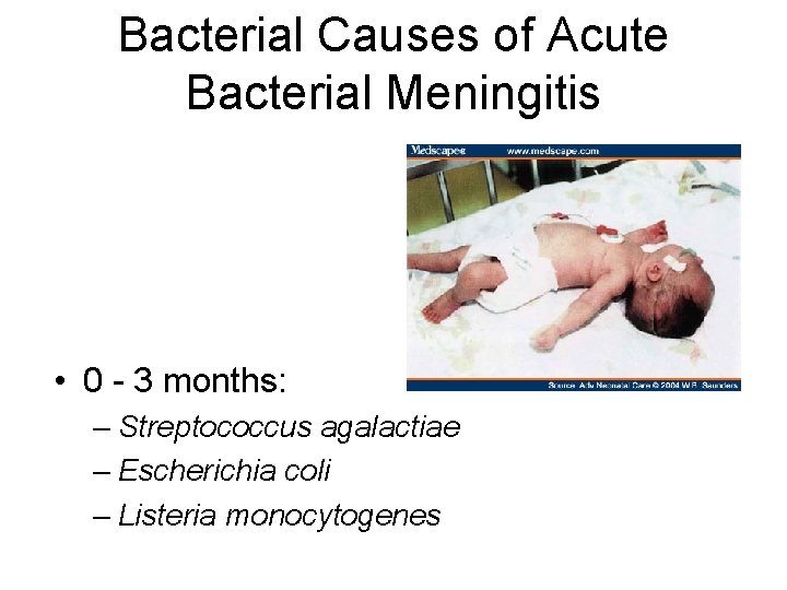 Bacterial Causes of Acute Bacterial Meningitis • 0 - 3 months: – Streptococcus agalactiae