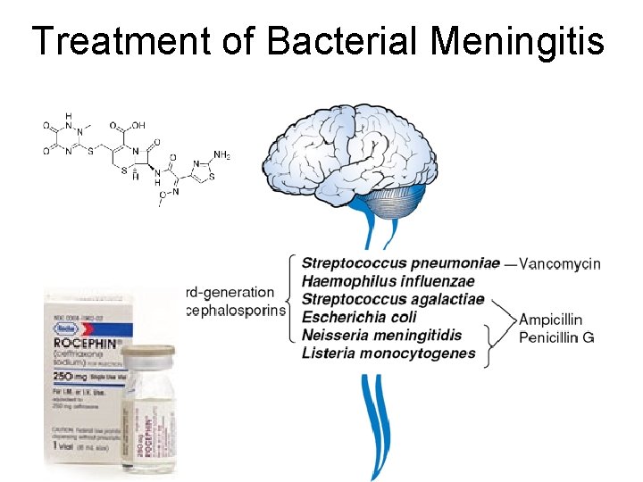 Treatment of Bacterial Meningitis 