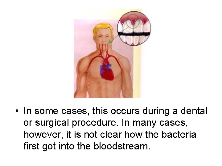  • In some cases, this occurs during a dental or surgical procedure. In