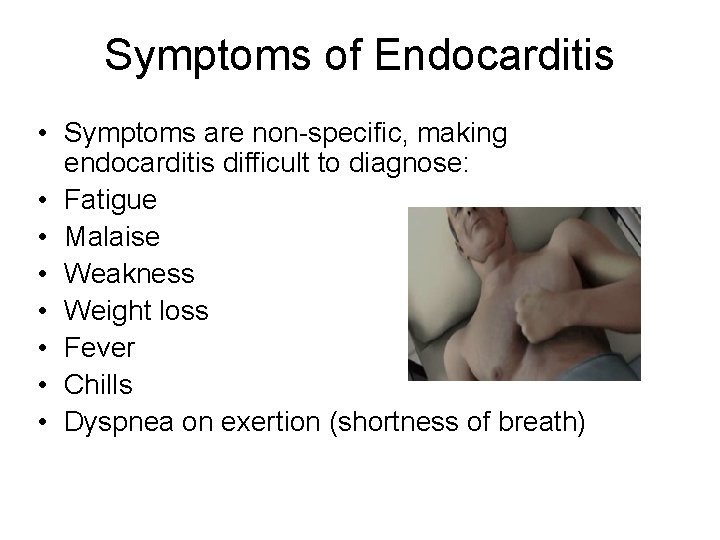 Symptoms of Endocarditis • Symptoms are non-specific, making endocarditis difficult to diagnose: • Fatigue