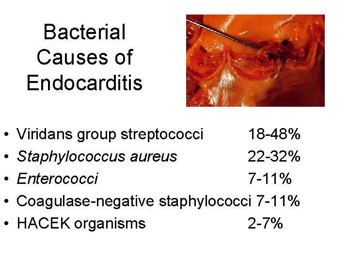 Bacterial Causes of Endocarditis • • • Viridans group streptococci 18 -48% Staphylococcus aureus Bacterial Causes of Endocarditis • • • Viridans group streptococci 18 -48% Staphylococcus aureus