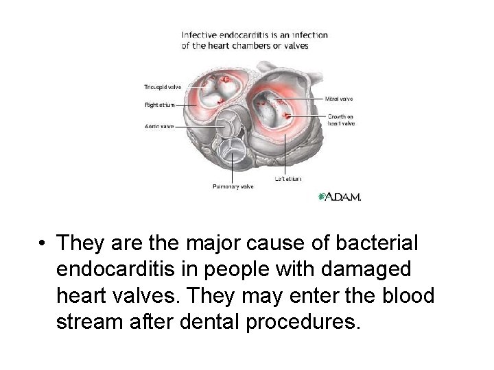  • They are the major cause of bacterial endocarditis in people with damaged