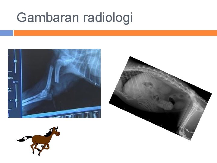 Gambaran radiologi 