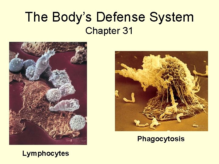 The Body’s Defense System Chapter 31 Phagocytosis Lymphocytes 
