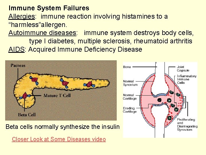Immune System Failures Allergies: immune reaction involving histamines to a “harmless”allergen. Autoimmune diseases: immune