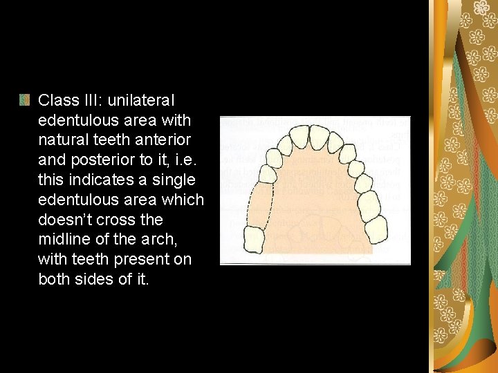 Class III: unilateral edentulous area with natural teeth anterior and posterior to it, i.