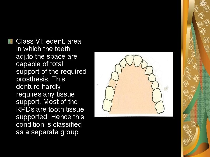 Class VI: edent. area in which the teeth adj. to the space are capable