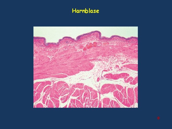 Harnblase * Harnblase *