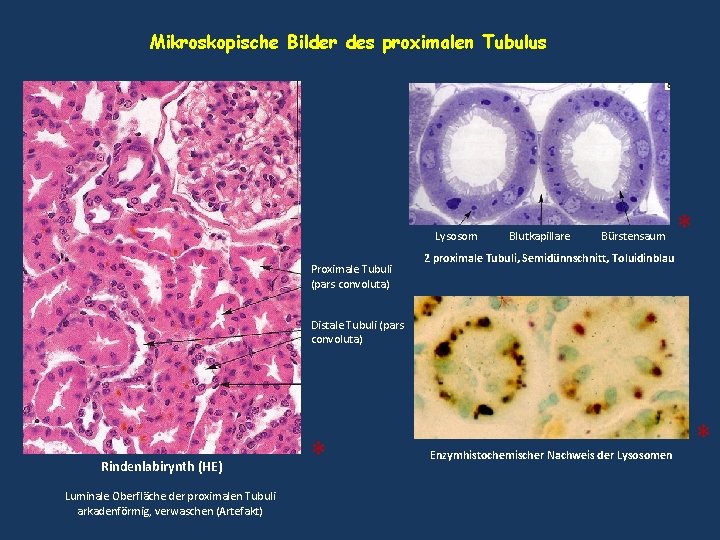 Mikroskopische Bilder des proximalen Tubulus Lysosom Proximale Tubuli (pars convoluta) Blutkapillare Bürstensaum * 2 Mikroskopische Bilder des proximalen Tubulus Lysosom Proximale Tubuli (pars convoluta) Blutkapillare Bürstensaum * 2