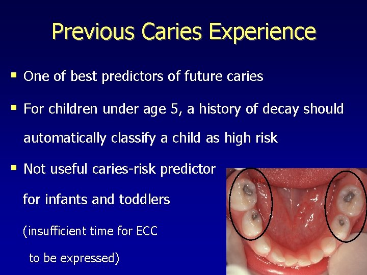 Previous Caries Experience § One of best predictors of future caries § For children