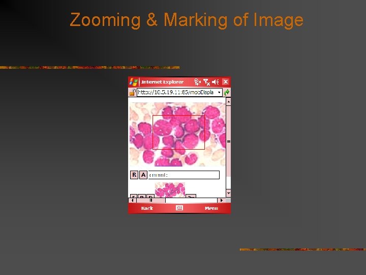 Zooming & Marking of Image 
