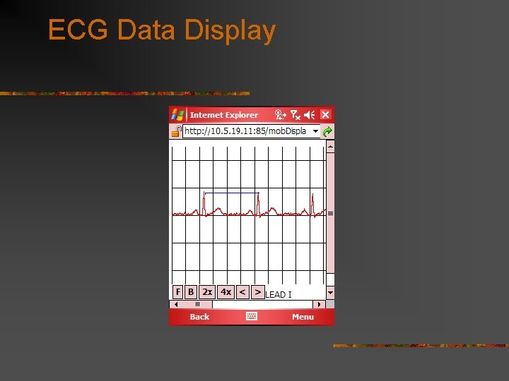 ECG Data Display 