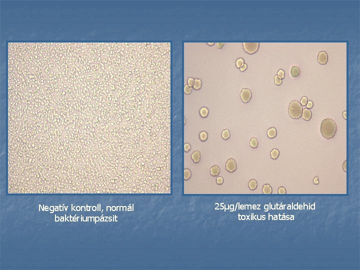 Negatív kontroll, normál baktériumpázsit 25μg/lemez glutáraldehid toxikus hatása 