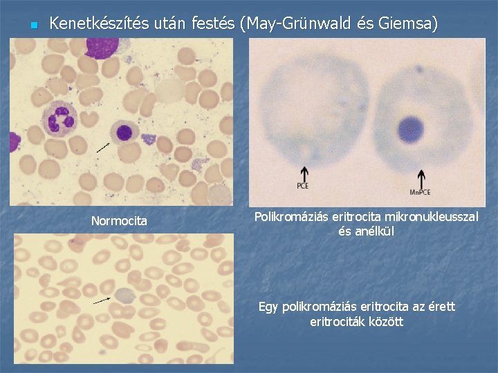 n Kenetkészítés után festés (May-Grünwald és Giemsa) Normocita Polikromáziás eritrocita mikronukleusszal és anélkül Egy