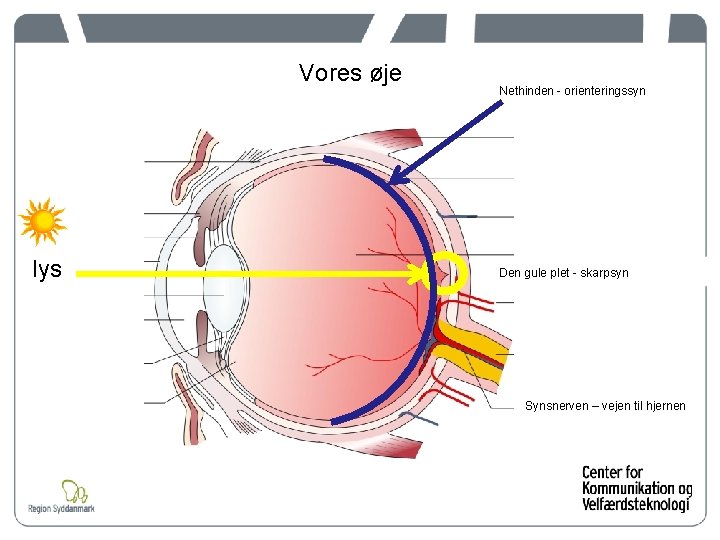 Vores øje lys Nethinden - orienteringssyn Den gule plet - skarpsyn Synsnerven – vejen