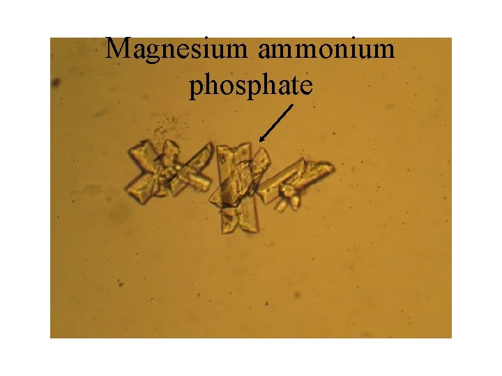 Magnesium ammonium phosphate 
