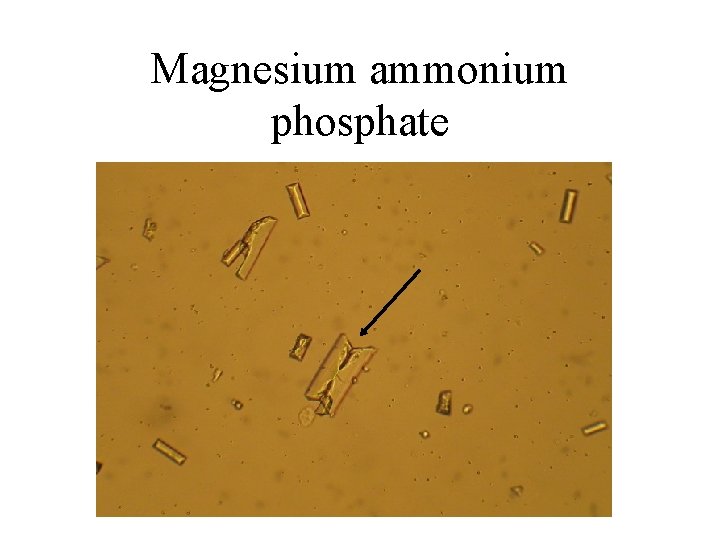 Magnesium ammonium phosphate 