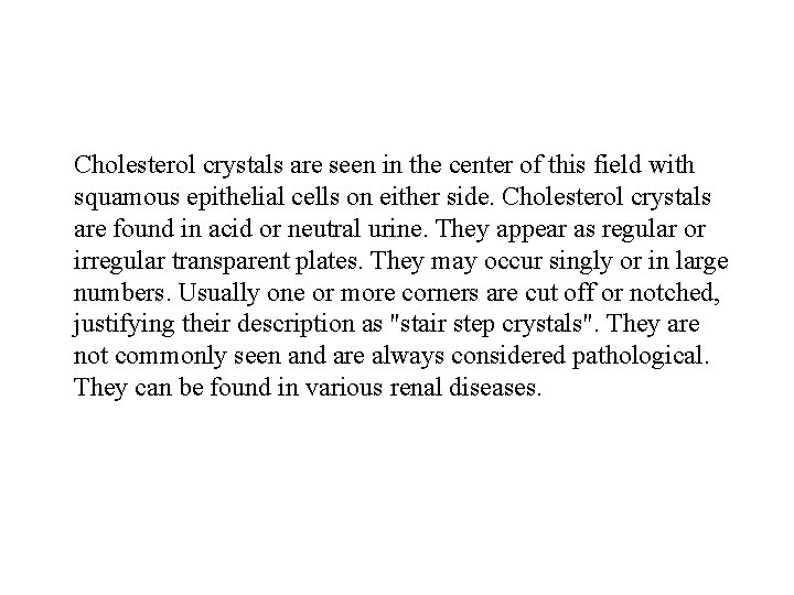 Cholesterol crystals are seen in the center of this field with squamous epithelial cells