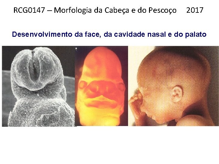 RCG 0147 – Morfologia da Cabeça e do Pescoço 2017 Desenvolvimento da face, da