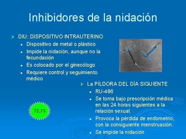 Inhibidores de la nidación Ø DIU: DISPOSITIVO INTRAUTERINO l Dispositivo de metal o plástico