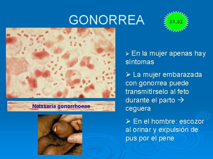 GONORREA 81, 82 Ø En la mujer apenas hay síntomas Neisseria gonorrhoeae Ø La