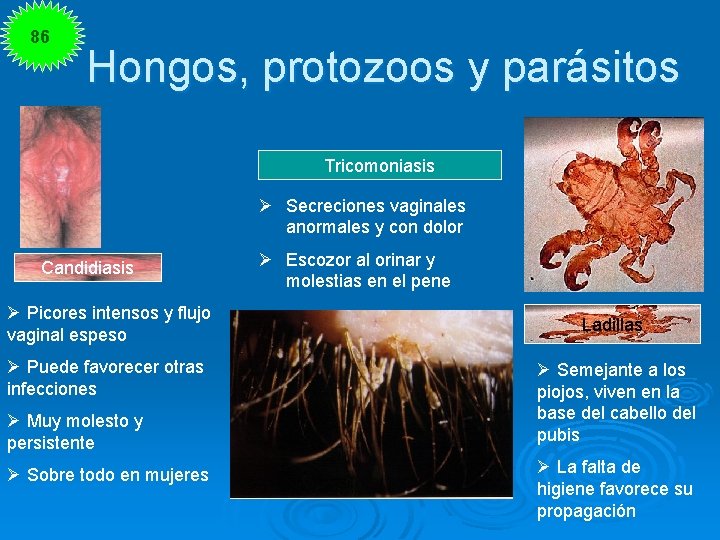 86 Hongos, protozoos y parásitos Tricomoniasis Ø Secreciones vaginales anormales y con dolor Candidiasis