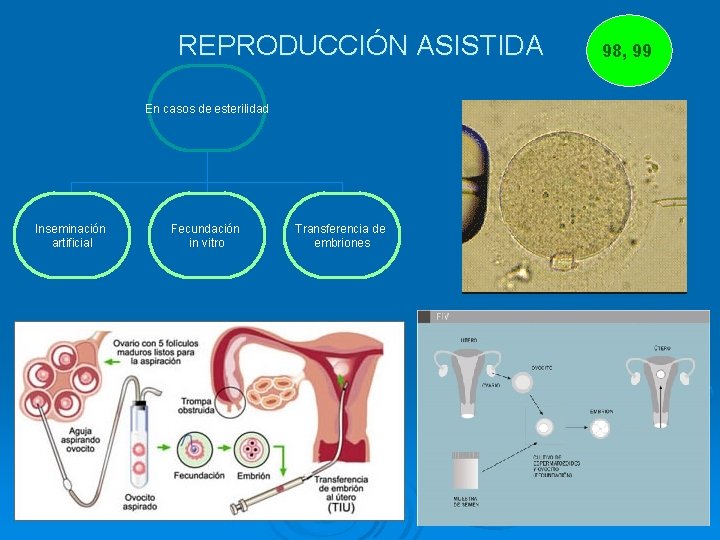 REPRODUCCIÓN ASISTIDA En casos de esterilidad Inseminación artificial Fecundación in vitro Transferencia de embriones