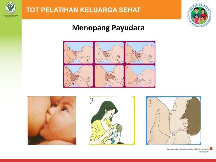Menopang Payudara 