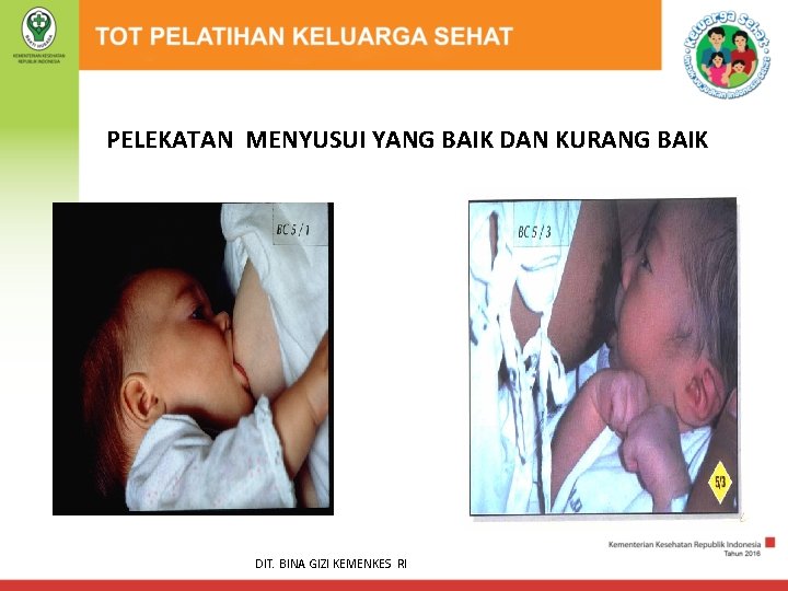PELEKATAN MENYUSUI YANG BAIK DAN KURANG BAIK DIT. BINA GIZI KEMENKES RI 
