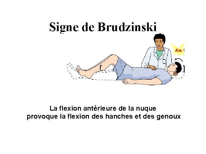 Signe de Brudzinski La flexion antérieure de la nuque provoque la flexion des hanches