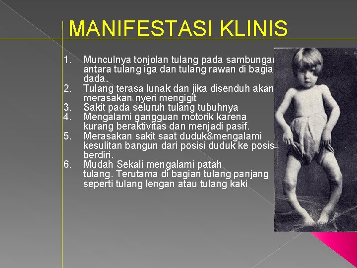 MANIFESTASI KLINIS 1. 2. 3. 4. 5. 6. Munculnya tonjolan tulang pada sambungan antara