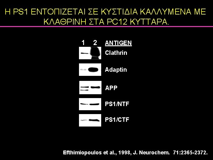 Η PS 1 ΕΝΤΟΠΙΖΕΤΑΙ ΣΕ ΚΥΣΤΙΔΙΑ ΚΑΛΛΥΜΕΝΑ ΜΕ ΚΛΑΘΡΙΝΗ ΣΤΑ PC 12 ΚΥΤΤΑΡΑ. 1 Η PS 1 ΕΝΤΟΠΙΖΕΤΑΙ ΣΕ ΚΥΣΤΙΔΙΑ ΚΑΛΛΥΜΕΝΑ ΜΕ ΚΛΑΘΡΙΝΗ ΣΤΑ PC 12 ΚΥΤΤΑΡΑ. 1